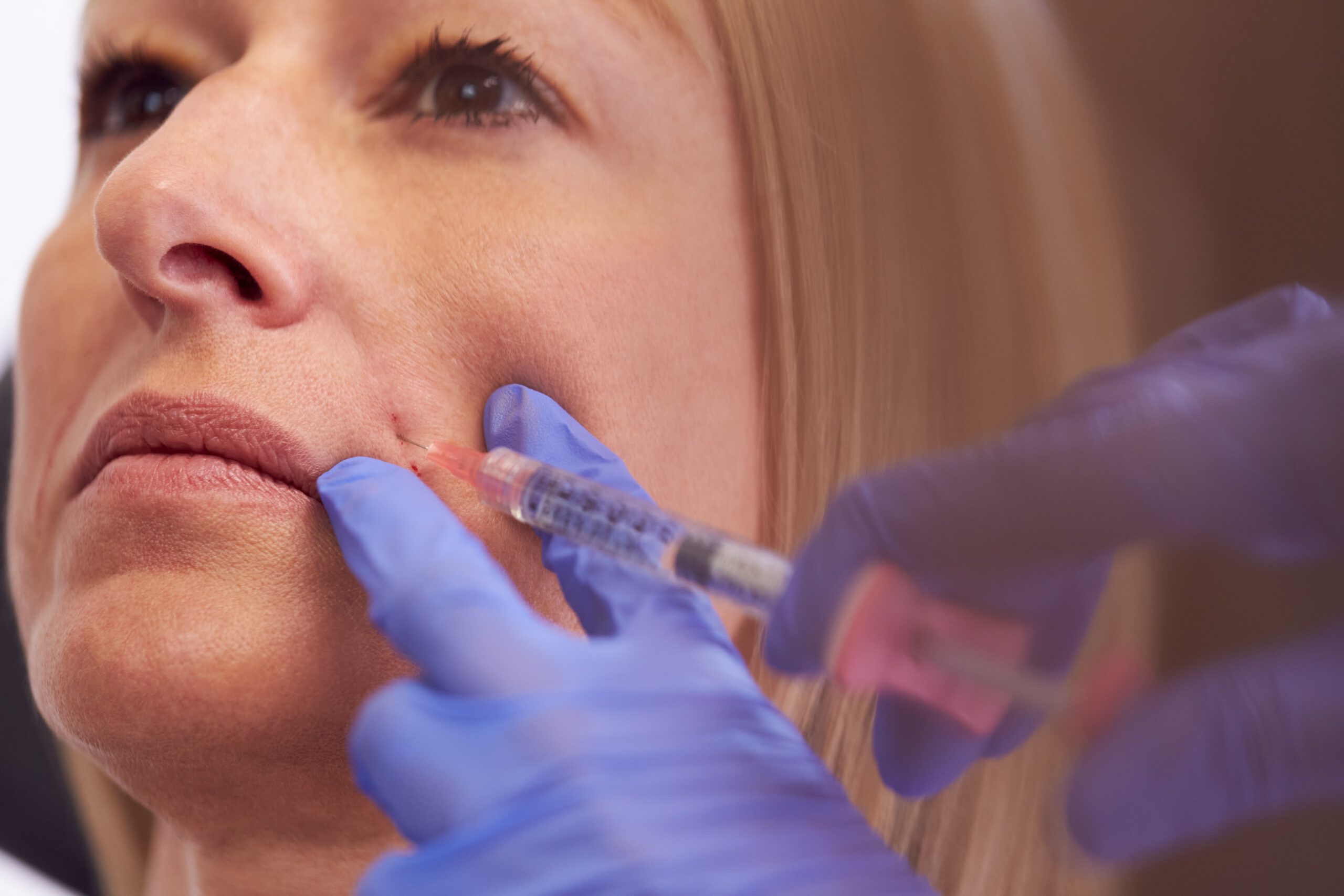 Botox in Westlake Village
