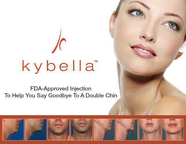 Kybella – Double Chin Treatment Northridge & Simi Valley