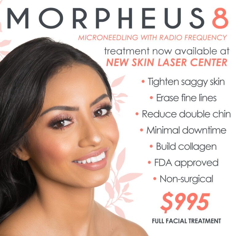 Morpheus8 microneedling with radiofrequency treatment now available at New Skin Laser Center. Tighten saggy skin, erase fine lines, reduce double chin, minimal downtime, build collagen, FDA approved, non-surgical treatment. $995 Full Facial Treatment.